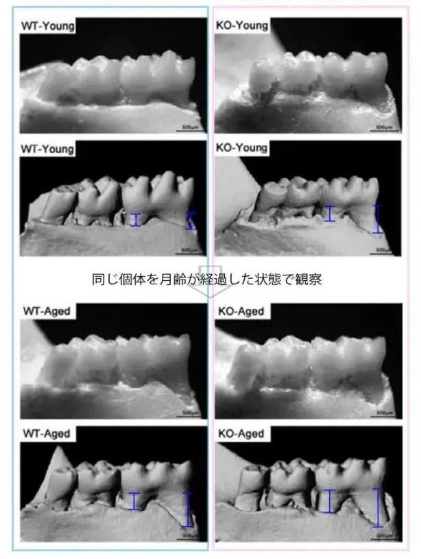 Taking NMN can prevent periodontal disease