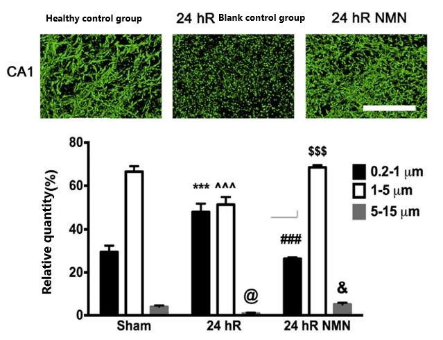 NMN maintains mitochondrial morphological integrity in CA1 cells of the mouse brain