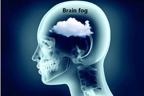 Brain fog