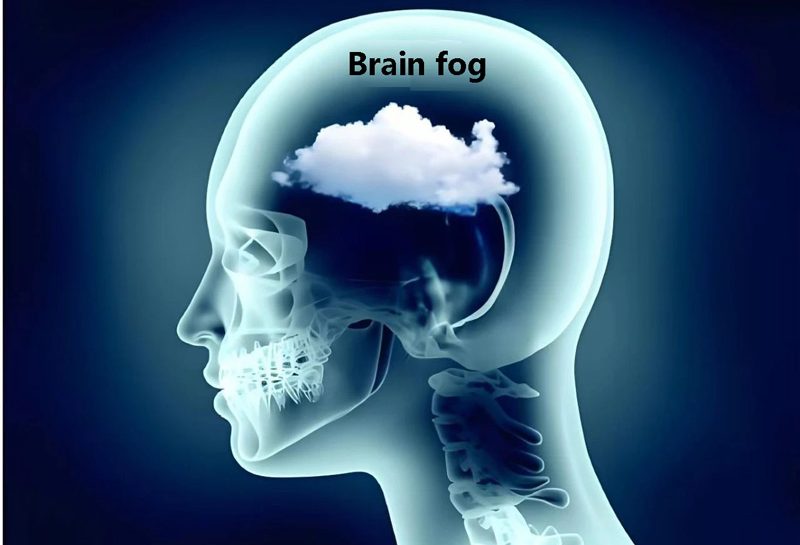 Brain fog