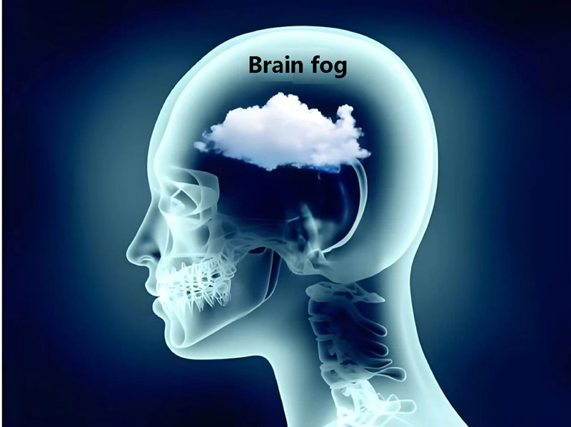 Brain fog