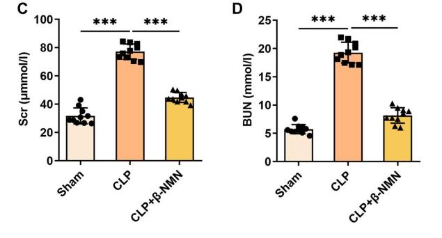 β-NMN can improve the pathological changes of kidney and reduce serum indexes