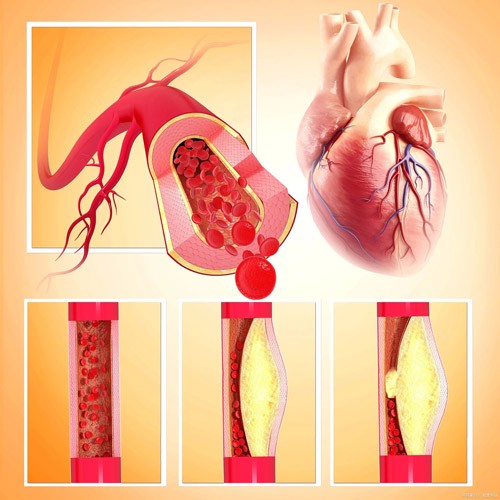 NMN can reverse various arterial problems