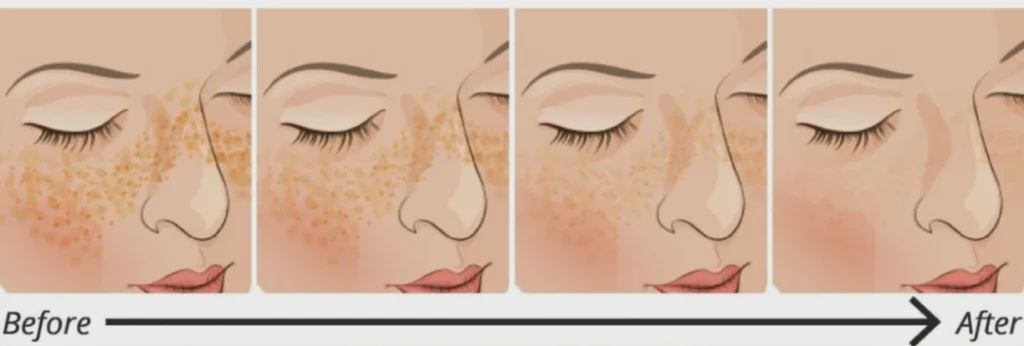 Comparison before and after taking glutathione